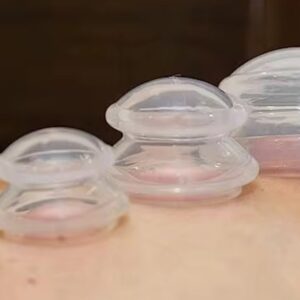 LOPPUUNMYYNTI!! Imukuppisetti kuivakuppaukseen